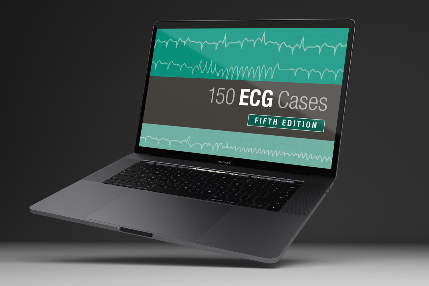 150 ECG Cases